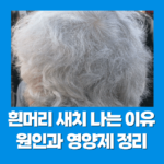 흰머리 새치 나는 이유 원인과 영양제 정리