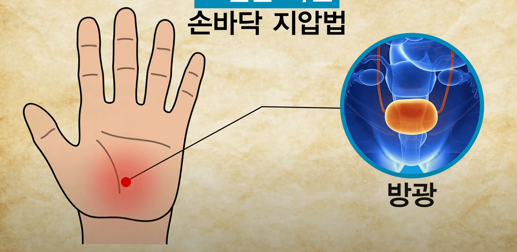 요실금 예방 혈자리 지압 방법 - 좋은 건강 뉴스