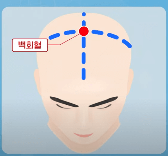 백회혈 혈자리