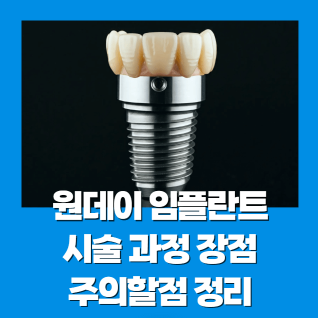 원데이 임플란트 시술 과정 장점 주의할점 정리