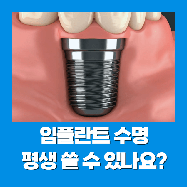 임플란트 수명